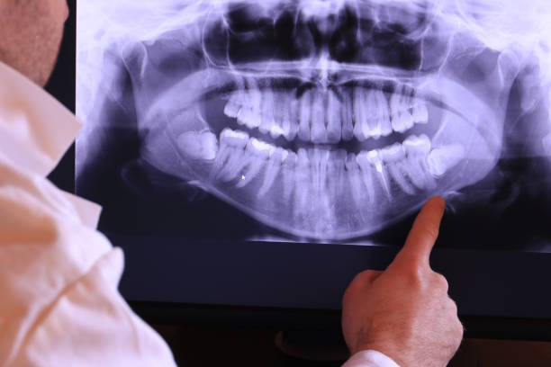 Urgent Tooth Repair in ND