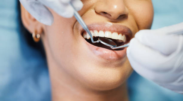 Best Urgent Tooth Repair  in Thompson, ND